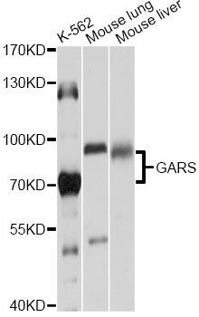 Western blot - GARS antibody (144-013305)