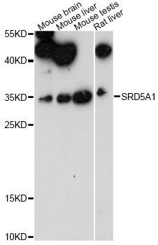 Western blot - SRD5A1 antibody (144-60795)