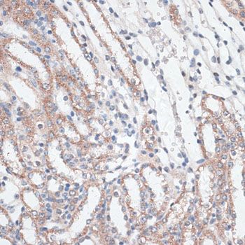 Immunohistochemistry - AHSP Polyclonal Antibody (144-06465)