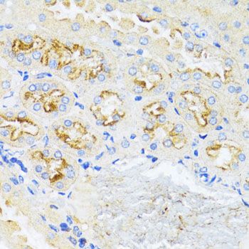 Immunohistochemistry - CCND1 Polyclonal Antibody (144-11022)