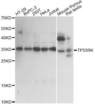 Western blot - TP53RK antibody (144-014952)