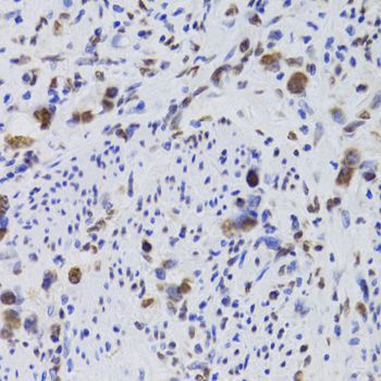 Immunohistochemistry - HDGF Antibody (144-05347)