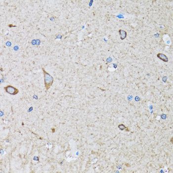 Immunohistochemistry - HIP1 Polyclonal Antibody (144-06921)