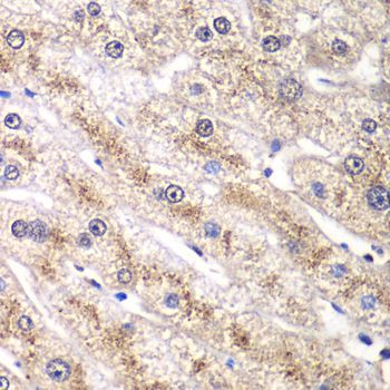 Immunohistochemistry - RALB antibody (144-61378)