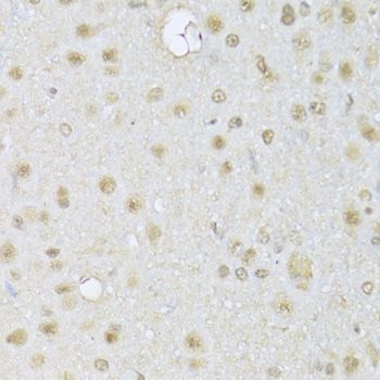 Immunohistochemistry - HDAC3 Polyclonal Antibody (144-02139)