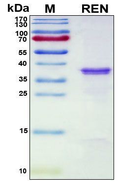 SDS-PAGE