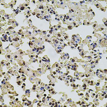 Immunohistochemistry - POT1 antibody (144-01491)