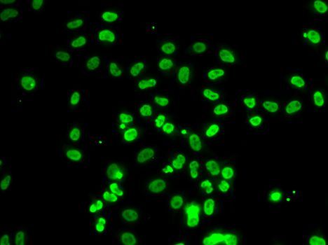 Immunofluorescence - ACTL6B Polyclonal Antibody (144-07108)