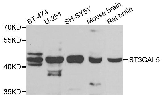Western blot - ST3GAL5 antibody (144-07947)