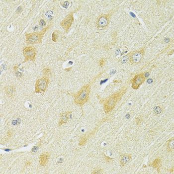 Immunohistochemistry - SLC25A1 Polyclonal Antibody (144-010247)