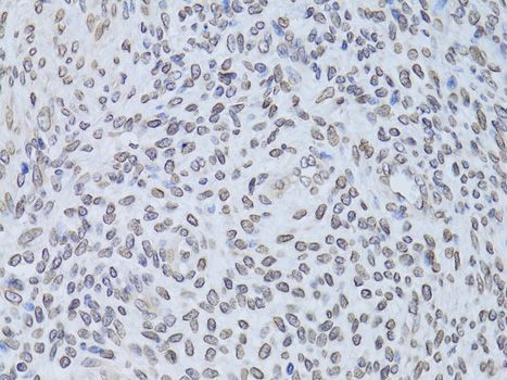 Immunohistochemistry - LMNB2 Polyclonal Antibody (144-06483)