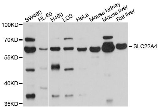 Western blot - SLC22A4 Polyclonal Antibody (144-010490)