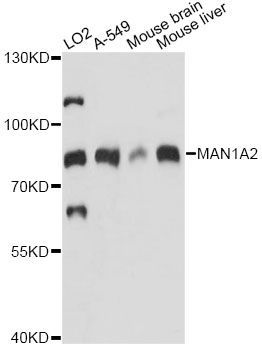 Western blot - MAN1A2 antibody (144-014271)