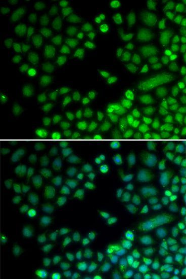 Immunofluorescence - RAD9A Polyclonal Antibody (144-01890)