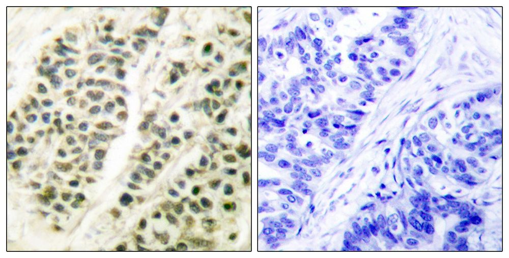 IHC