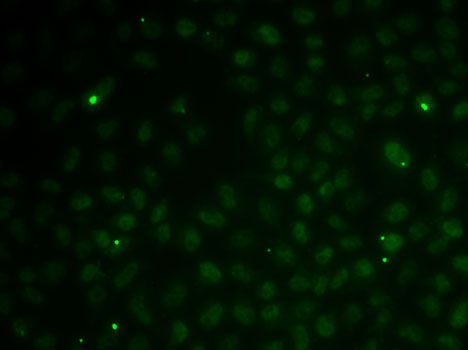 Western blot