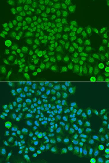Immunofluorescence - TARDBP antibody (144-013405)