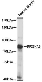 Western blot