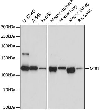 Western blot - MIB1 antibody (144-08588)