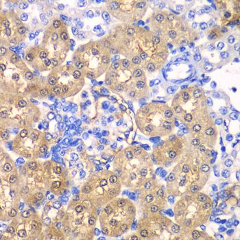 Immunohistochemistry - HPD antibody (144-06505)