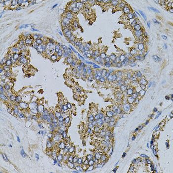 Immunohistochemistry - NPC2 Antibody (144-05413)