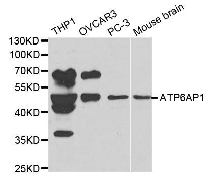 Western blot - ATP6AP1 antibody (144-01209)