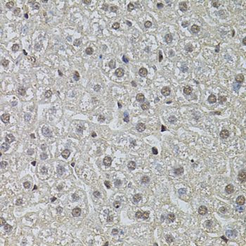 Immunohistochemistry - POP4 antibody (144-04452)