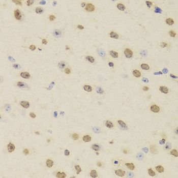 Immunohistochemistry - HNRNPD Polyclonal Antibody (144-01828)
