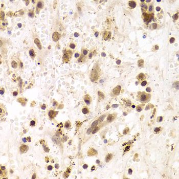 Immunohistochemistry - PRPF3 Polyclonal Antibody (144-05482)