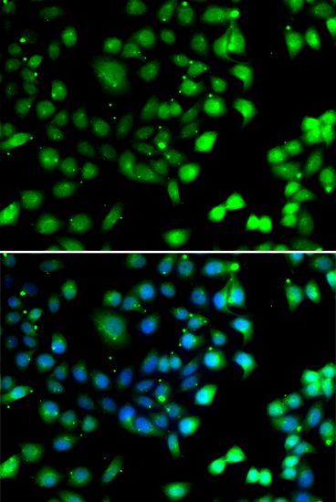 Immunofluorescence - NTMT1 Polyclonal Antibody (144-07098)