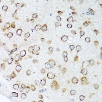 Immunohistochemistry - NOTCH2 Polyclonal Antibody (144-00560)