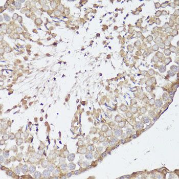 Immunohistochemistry - OPRK1 Polyclonal Antibody (144-60557)