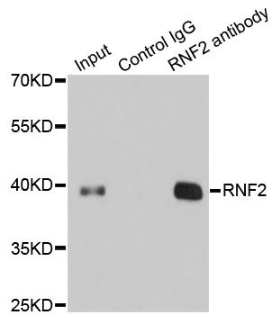 Immunoprecipitation - RNF2 Polyclonal Antibody (144-05563)