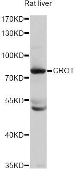 Western blot - CROT Polyclonal Antibody (144-04790)