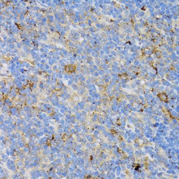 Immunohistochemistry - CD4 Polyclonal Antibody (144-60019)
