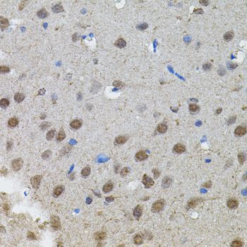 Immunohistochemistry - MYCN Polyclonal Antibody (144-00499)