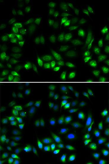Immunofluorescence - MANF antibody (144-07005)