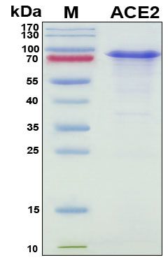 SDS-PAGE