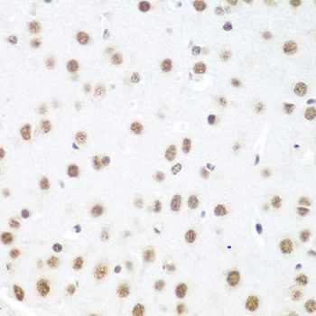 Immunohistochemistry - DDX39B Polyclonal Antibody (144-08356)