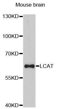 Western blot - LCAT Polyclonal Antibody (144-011741)