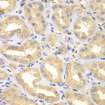 Immunohistochemistry - ELMO3 Polyclonal Antibody (144-07182)