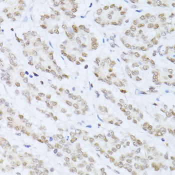 Immunohistochemistry - SIRT1 Polyclonal Antibody (144-011267)