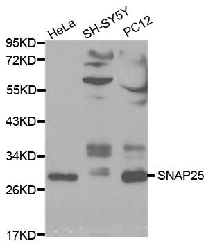 Western blot - SNAP25 Polyclonal Antibody (144-00986)