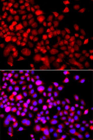 Immunofluorescence - CALCOCO1 antibody (144-07987)