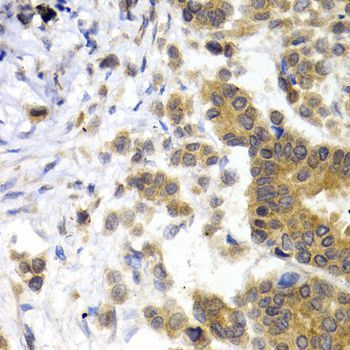 Immunohistochemistry - NEFL Polyclonal Antibody (144-00257)
