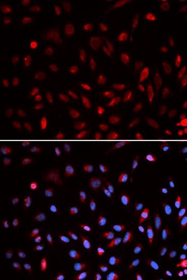 Immunofluorescence - ERCC1 Polyclonal Antibody (144-05291)