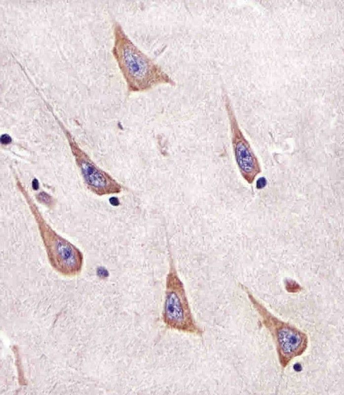 IHC-P