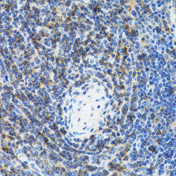 Immunohistochemistry - SRP19 Polyclonal Antibody (144-06752)