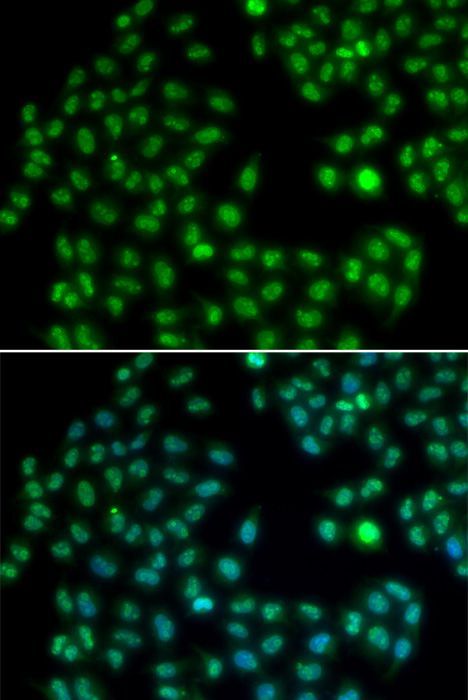 Immunofluorescence - MKI67 Polyclonal Antibody (144-02094)