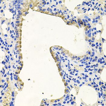 Immunohistochemistry - PKN1 Polyclonal Antibody (144-00553)